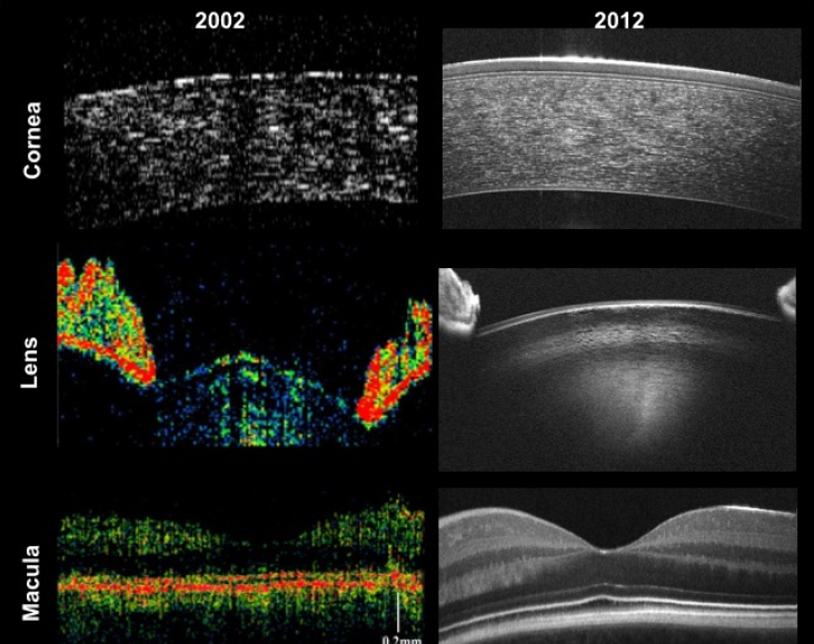 optical coherence tomography information phase